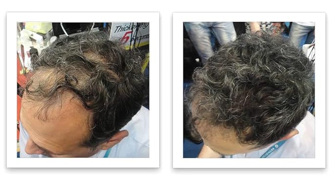 Trial Size - Eliminate Bald Spot and Thinning Hair Instantly. Make Thin Hair Look 10X Fuller. All-Natural Hair Thickening Fiber. Salt & Pepper - Dark