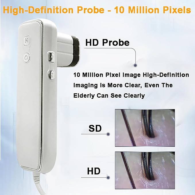 Four-Spectrum Hair Scalp Skin Oil and Analyzer, 15-Inch LCD Screen Hair Skin Analyzer Machine 50X 200X Skin Hair Scalp Detector with Storage Function Four-Grid Comparison