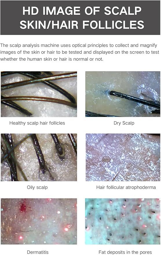 11 Inch Skin Analyzer Machine Professional Scalp Detector Hair Follicles Oil Moisture Tester Digital Hair Microscope Facial Skin Scalp Analysis Machine 50X-200X