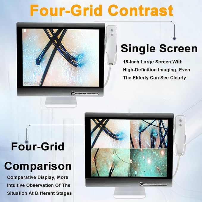Four-Spectrum Hair Scalp Skin Oil and Analyzer, 15-Inch LCD Screen Hair Skin Analyzer Machine 50X 200X Skin Hair Scalp Detector with Storage Function Four-Grid Comparison