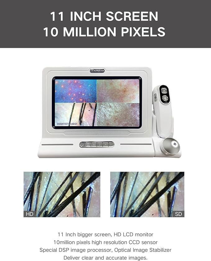 11 Inch Skin Analyzer Machine Professional Scalp Detector Hair Follicles Oil Moisture Tester Digital Hair Microscope Facial Skin Scalp Analysis Machine 50X-200X