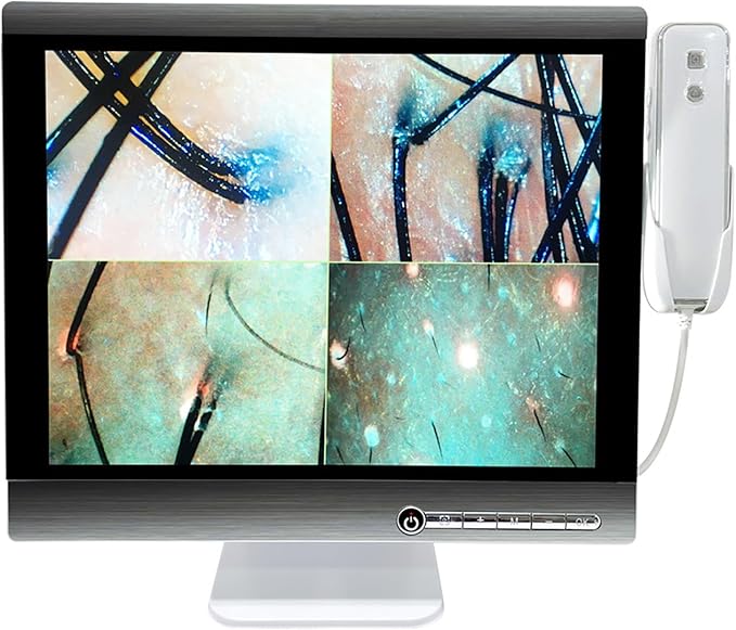 Four-Spectrum Hair Scalp Skin Oil and Analyzer, 15-Inch LCD Screen Hair Skin Analyzer Machine 50X 200X Skin Hair Scalp Detector with Storage Function Four-Grid Comparison