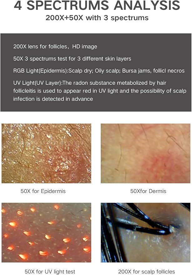 11 Inch Skin Analyzer Machine Professional Scalp Detector Hair Follicles Oil Moisture Tester Digital Hair Microscope Facial Skin Scalp Analysis Machine 50X-200X