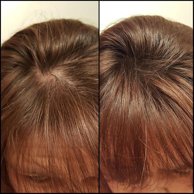 Thinning Hair Solution - All-Natural, Plant-Based Fibers For Fuller, Thicker Appearance. Instantly Covers Bald Spots. Auburn (red/ginger hair). Trial Size, 10-Day Supply