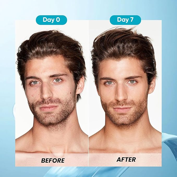 Calvris Scalp & Beard Comfort Cream – Steroid-Free Botanical Formula with Kudzu Root, Goldthread & Jojoba Extract for Dry, Flaky or Sensitive Skin, Cooling Non-Greasy Texture, 3.4 fl oz (1)