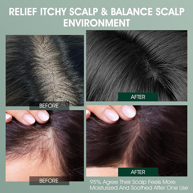 Scalp Treatment, Rosemary Refreshing Scalp Treatment with Tea Tree, Clarifying Build Up & Purifying, Leave-In Scalp Detox for Dry Itchy Scalp,Vegan & Cruelty-Free,120ML