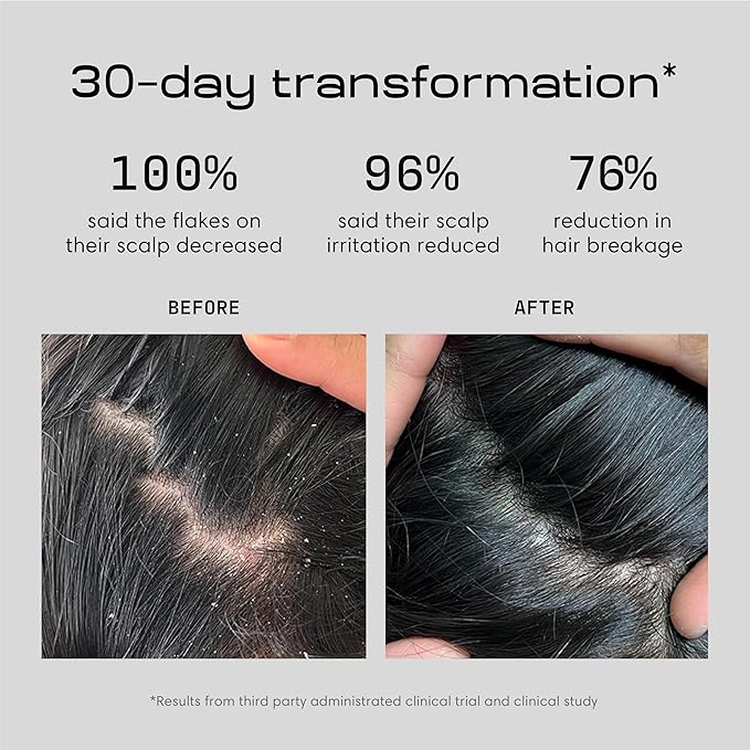 Jupiter Balancing Shampoo and Restoring Serum - Anti Dandruff Shampoo & Serum for Flaky, Itchy, Oily, & Dry Scalp - Nourishes Scalp, Reduces Breakage & Flakes - Color-Safe, Sulfate-Free, Paraben-Free