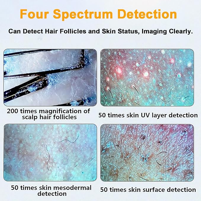 Four-Spectrum Hair Scalp Skin Oil and Analyzer, 15-Inch LCD Screen Hair Skin Analyzer Machine 50X 200X Skin Hair Scalp Detector with Storage Function Four-Grid Comparison