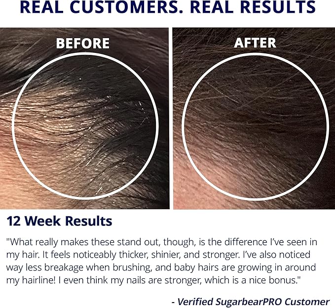 Sugarbear Bamboo Scalp Massager & Scrubber + Vegan Hair Vitamin Gummies 3 Month Supply, Extra Strength Biotin 6000mcg for Relaxing Scalp Care & Supporting Healthy Hair